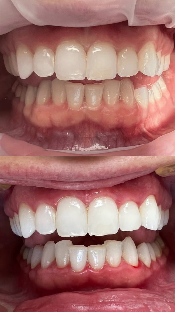 Mountain Ridge Dental | Dental | Bozeman, MT