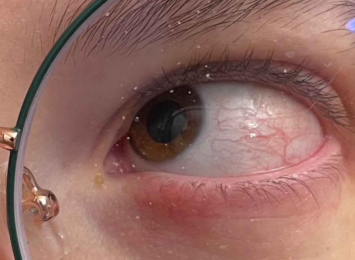 Dr. Libby Kristal, MD | Eye Clinic | Henderson, NV