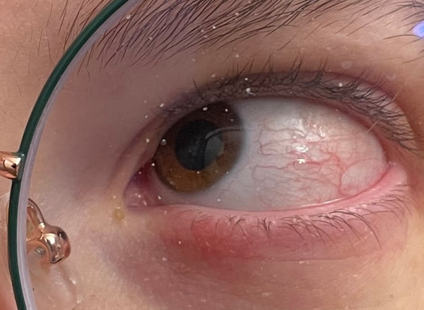 Dr. Libby Kristal, MD | Eye Clinic | Henderson, NV