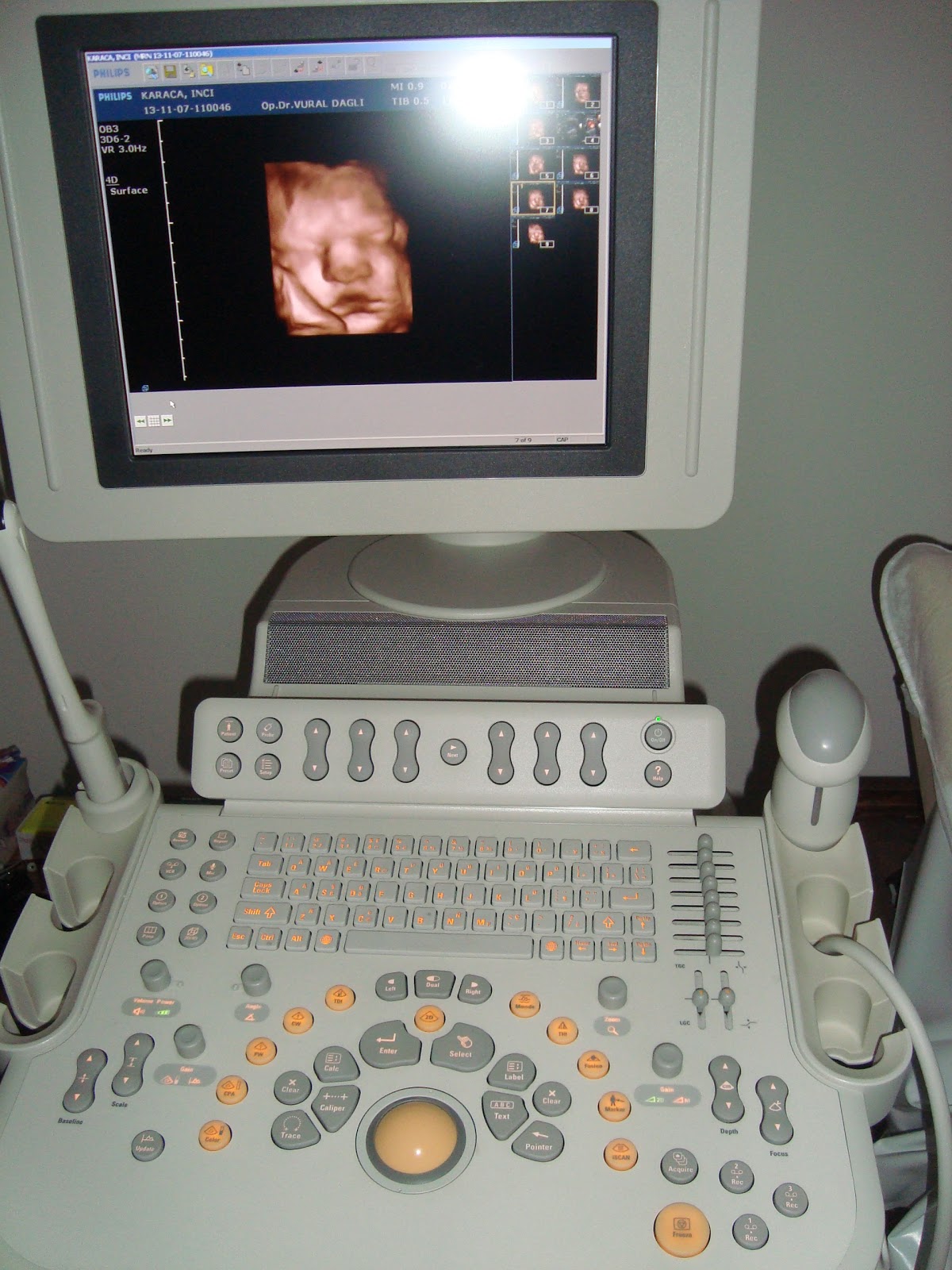 Jinekolog Op. Dr. Vural DAĞLI, Kadın Hastalıkları ve Doğum Uzmanı — Dr.Visor photo 5