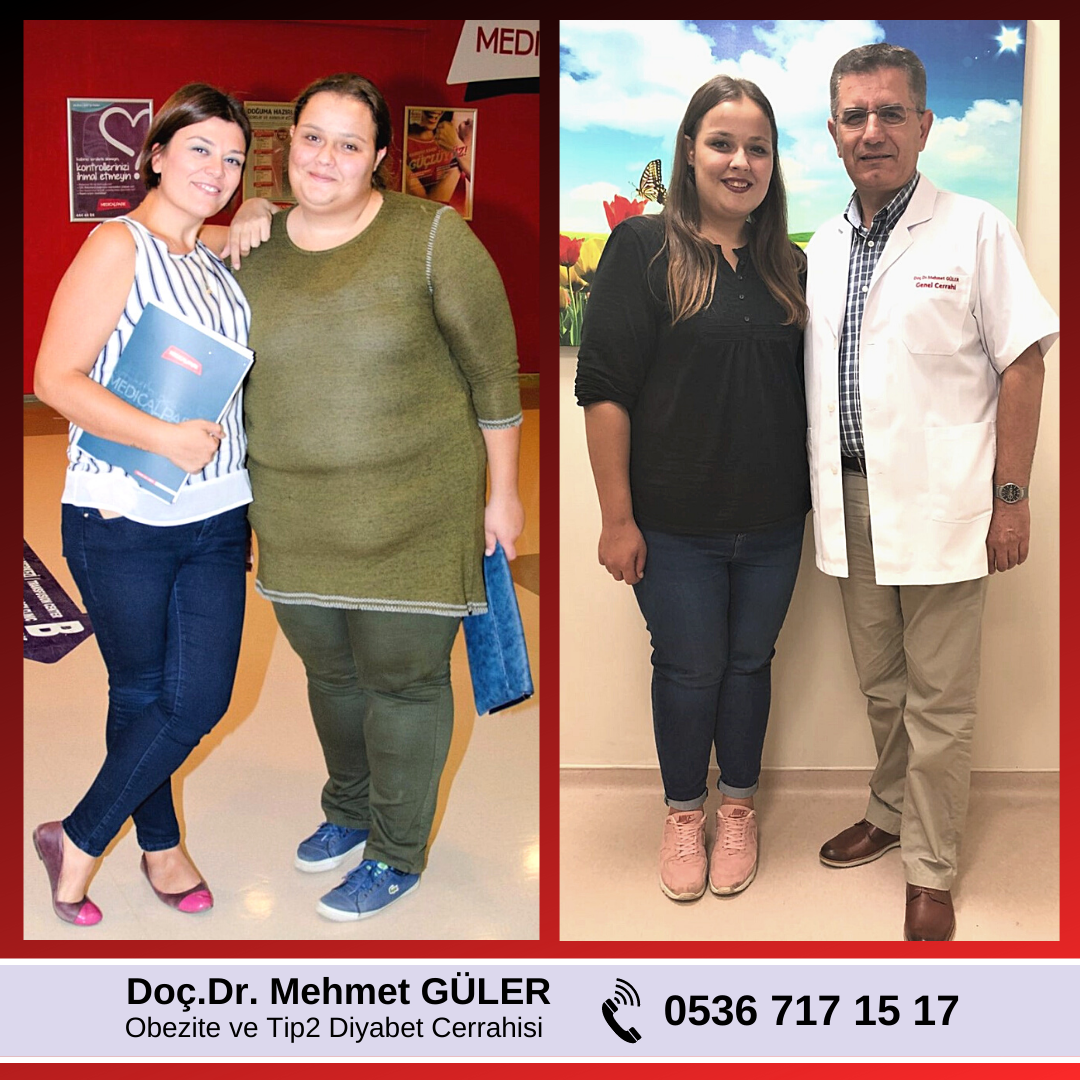 Prof. Dr. Mehmet GÜLER - Obezite ve Metabolik Cerrahi - Gastric Sleeve & Gastric Bypass — Dr.Visor photo 2