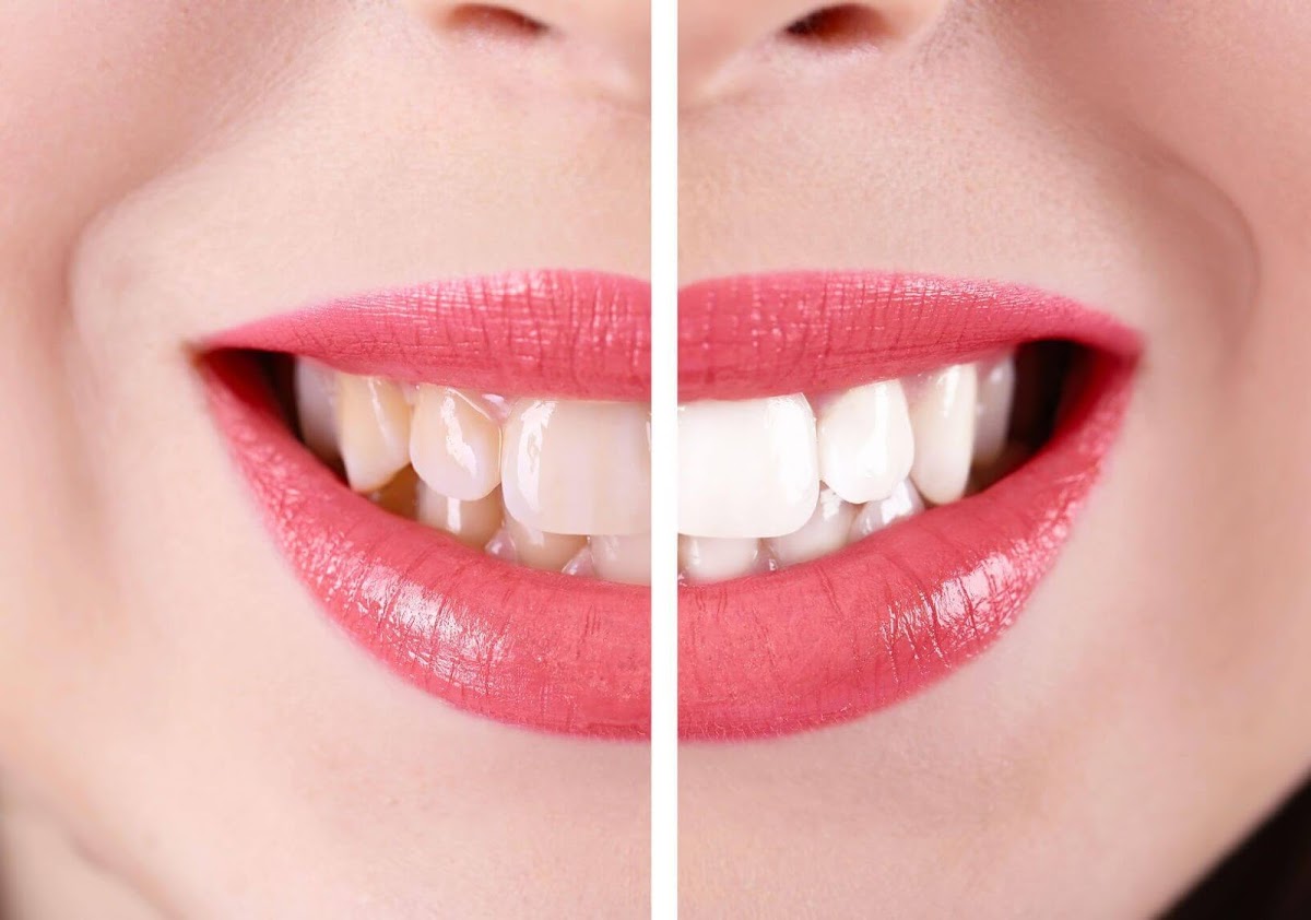 Citrus Dental Care — Dr.Visor photo 5