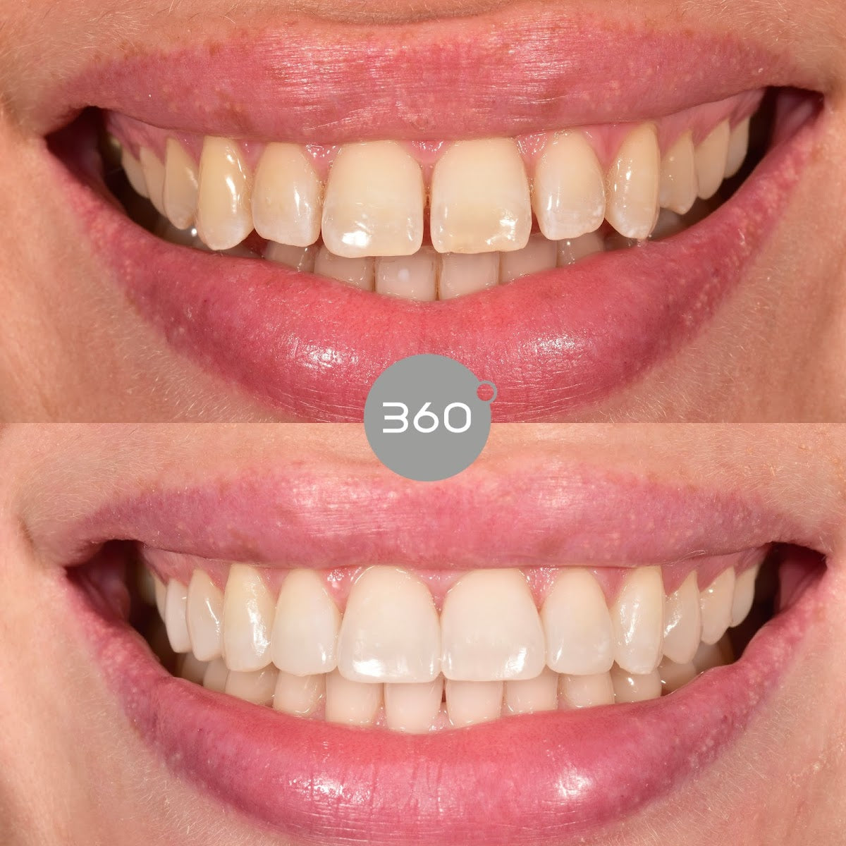 360 Dental Care — Dr.Visor