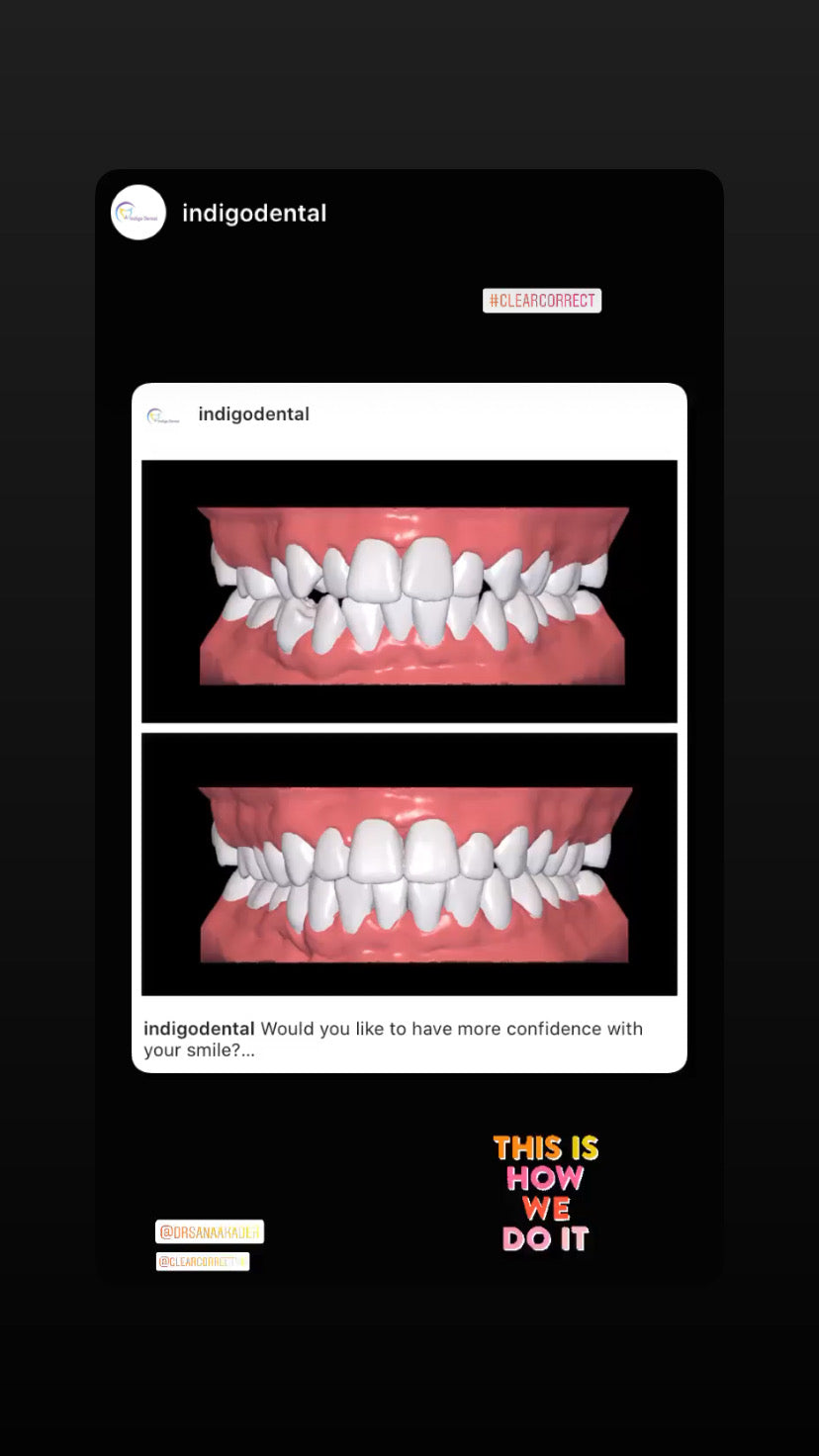 Indigo Dental — Dr.Visor photo 3