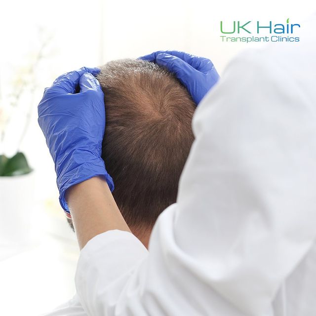 UK Hair Transplant Clinics Leeds — Dr.Visor photo 4