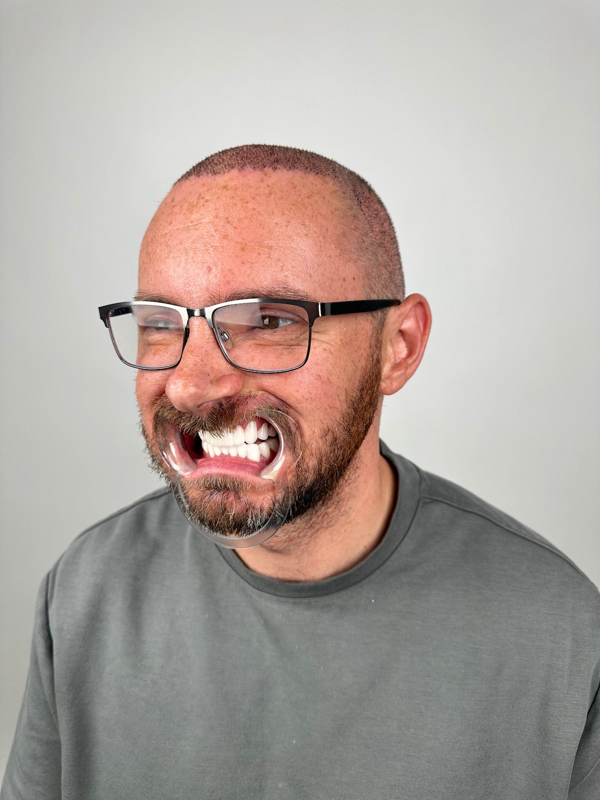 Best Dentist Istanbul | Dental | Hair Transplant | Hospital — Dr.Visor photo 5