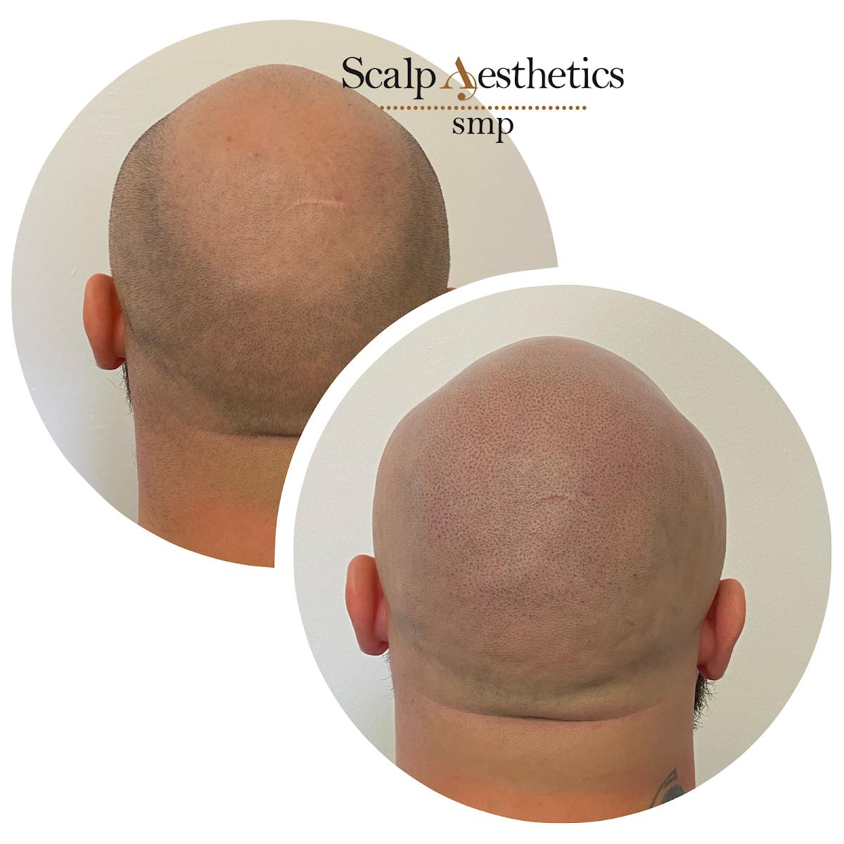 Scalp Aesthetics smp — Dr.Visor photo 3