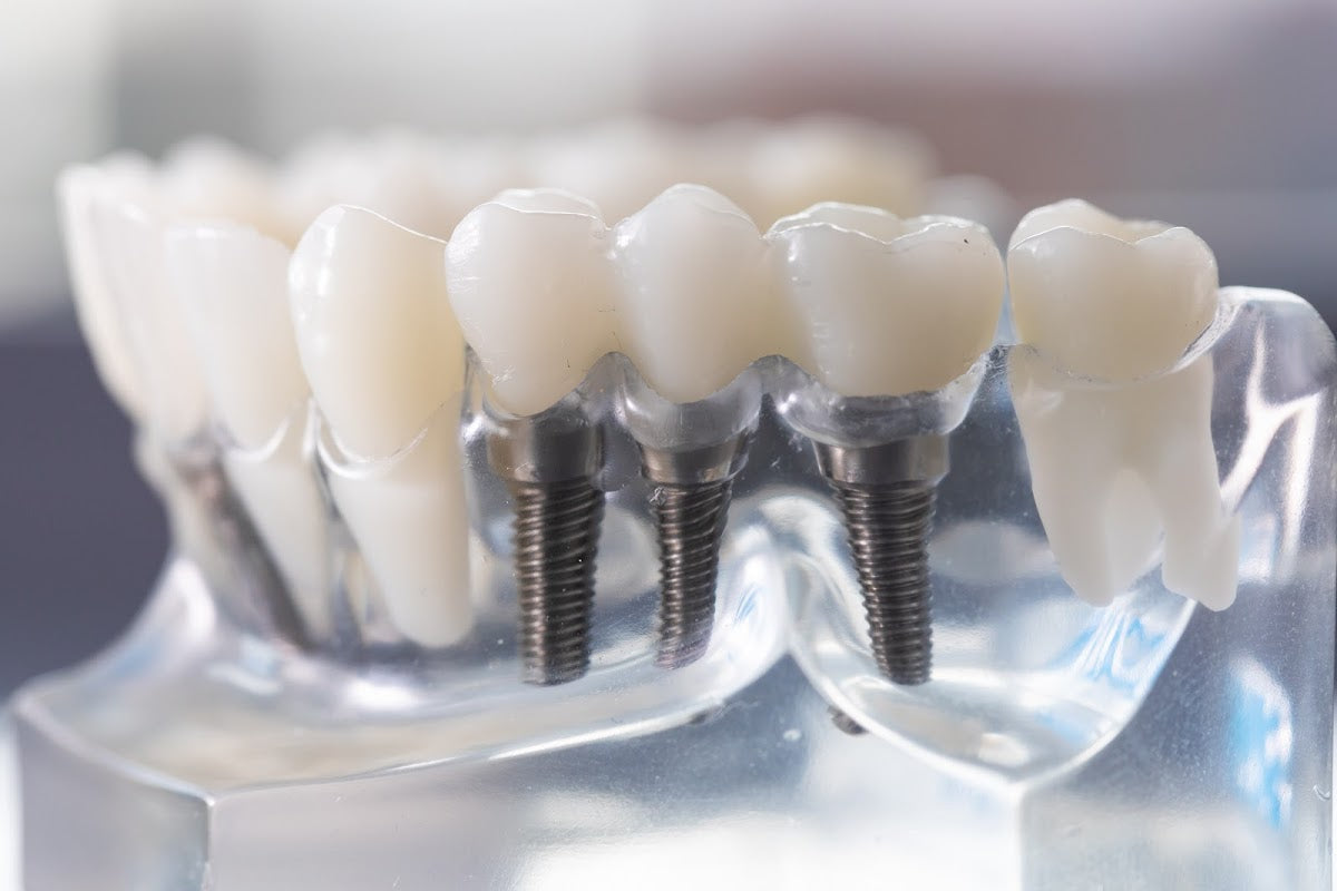 3Dental Dublin — Dr.Visor photo 2