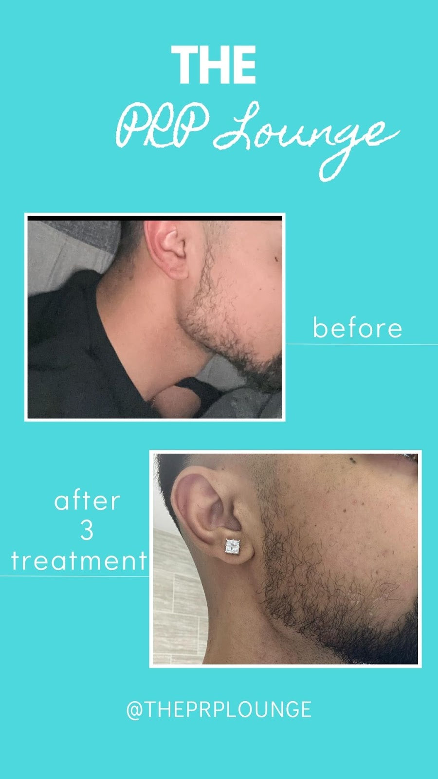 THE PRP LOUNGE - HAIR & SKIN TREATMENT BIRMINGHAM — Dr.Visor photo 4