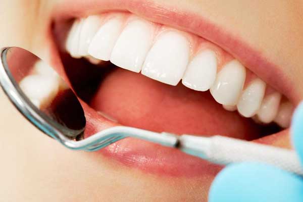 dental clinic istanbul turkey - Implant Treatment - veneers — Dr.Visor photo 4