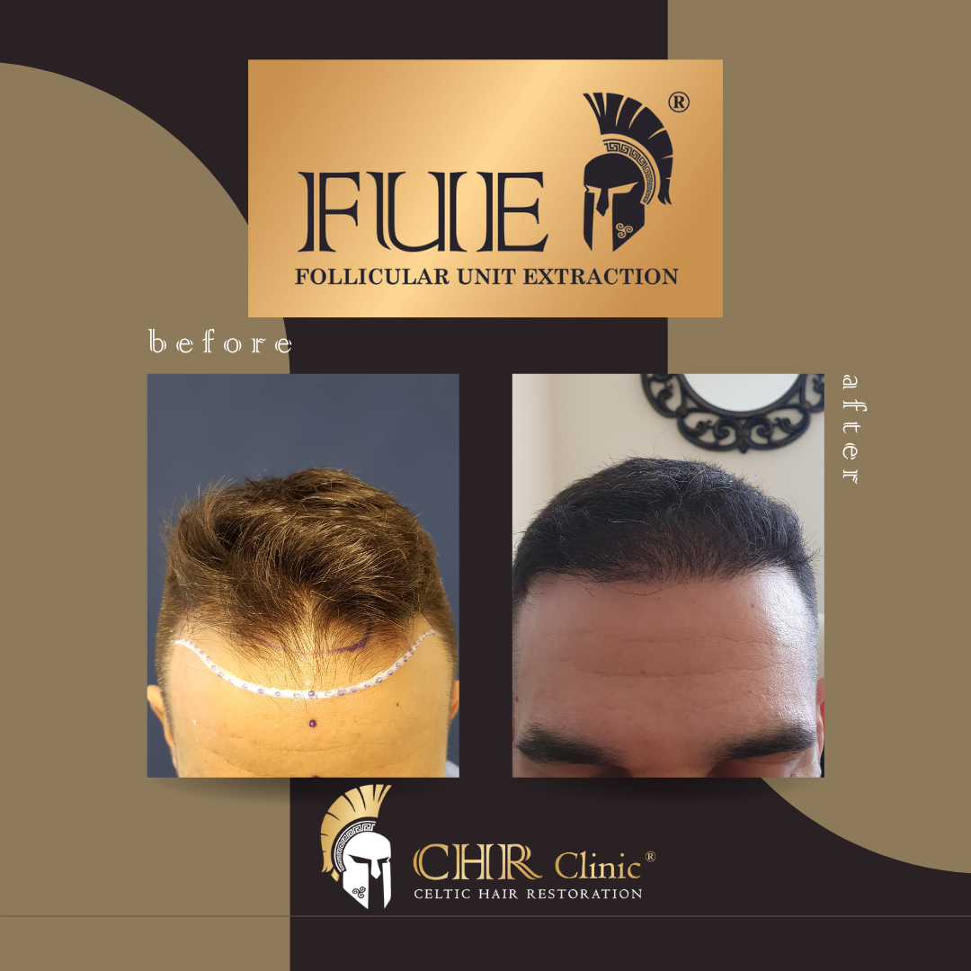 Celtic Hair Restoration Clinic — Dr.Visor photo 2