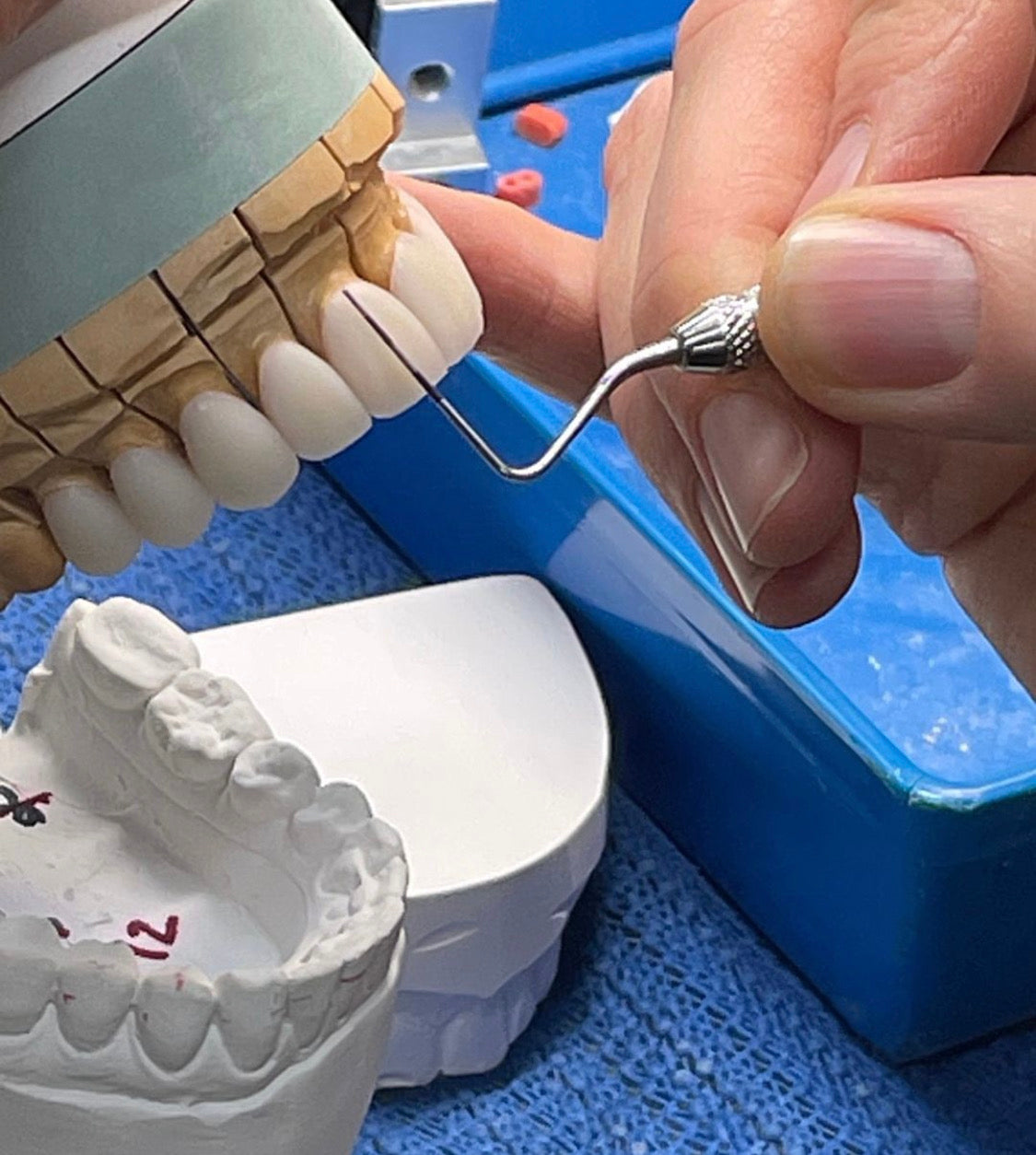 The London Smile Clinic — Dr.Visor photo 5