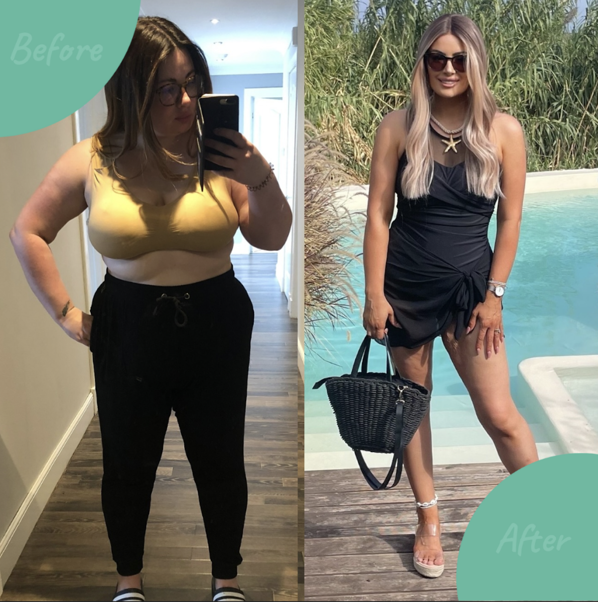 Tonic Weight Loss Surgery — Dr.Visor photo 4