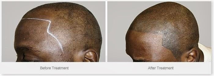 HIS Hair Clinic — Dr.Visor photo 4