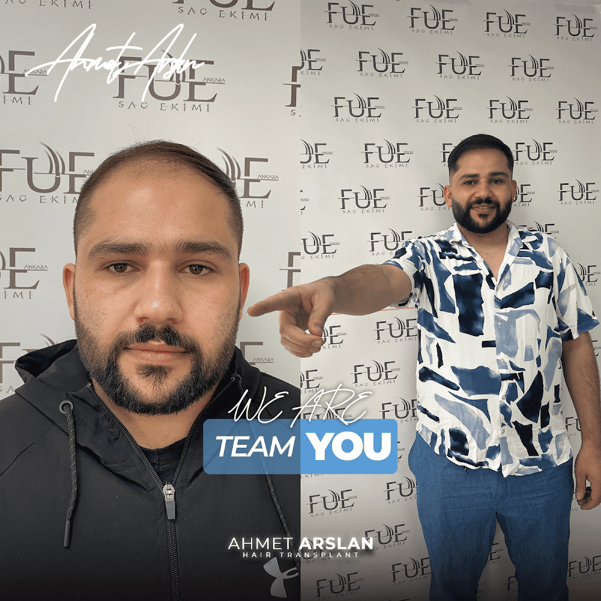 Ahmet Arslan Hair Transplant | Ankara Saç Ekimi PRP — Dr.Visor photo 4