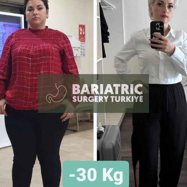 Bariatric Surgery Turkey
