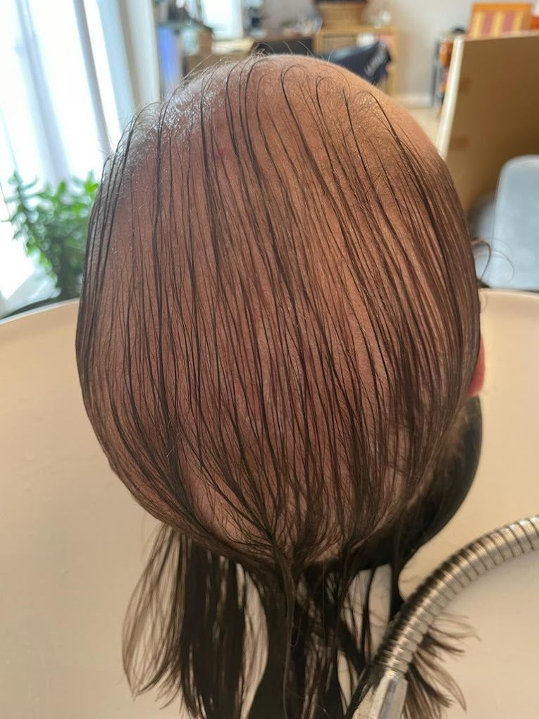 Hairlossandscalpclinic — Dr.Visor photo 5