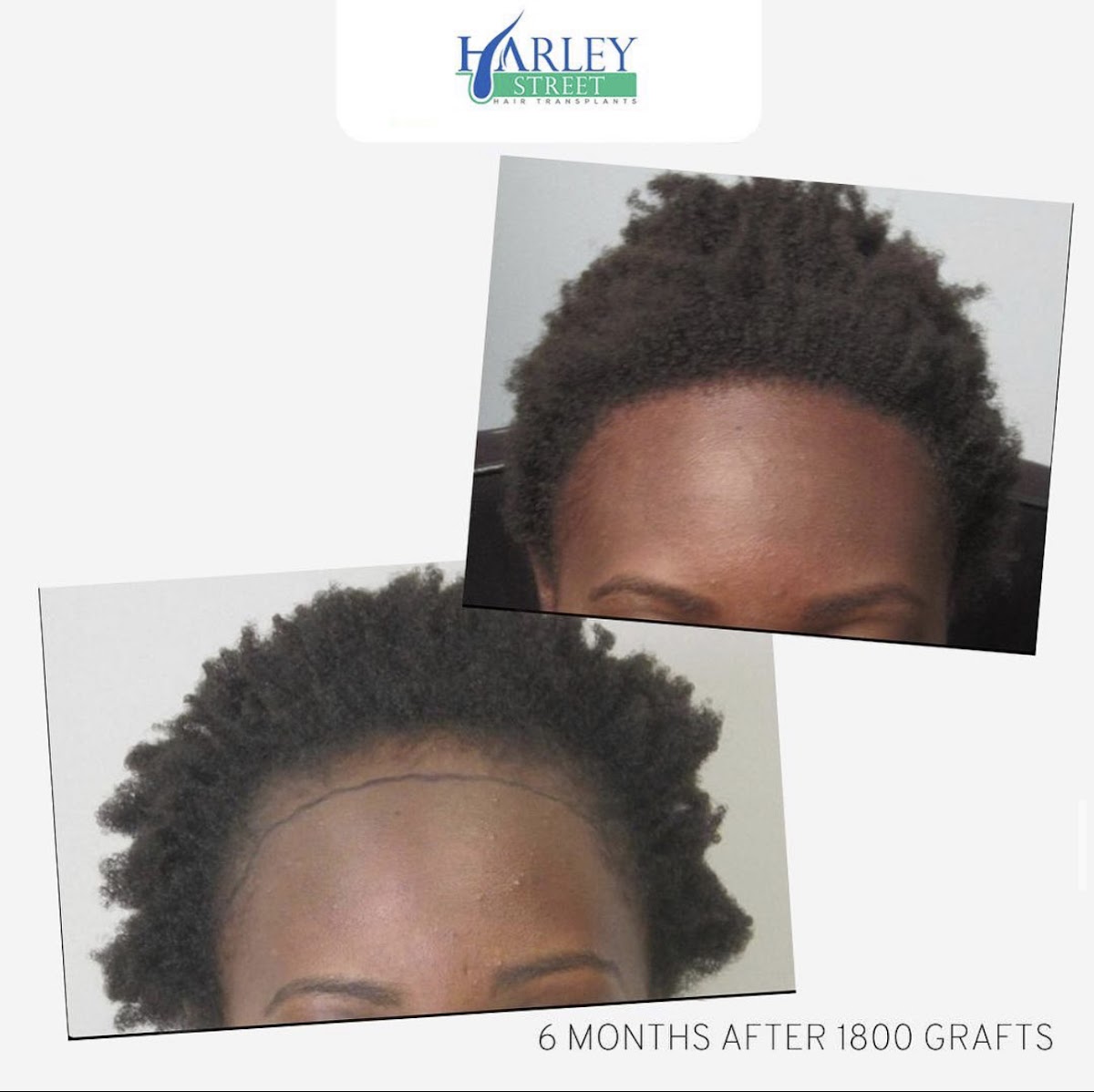 Edinburgh Hair Transplant Clinics — Dr.Visor photo 4