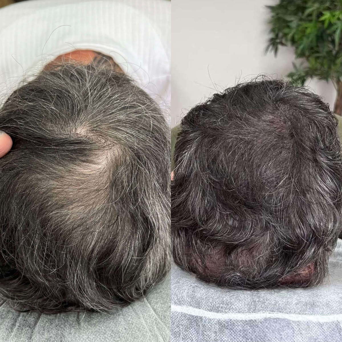 The Hairline Guy — Dr.Visor photo 3