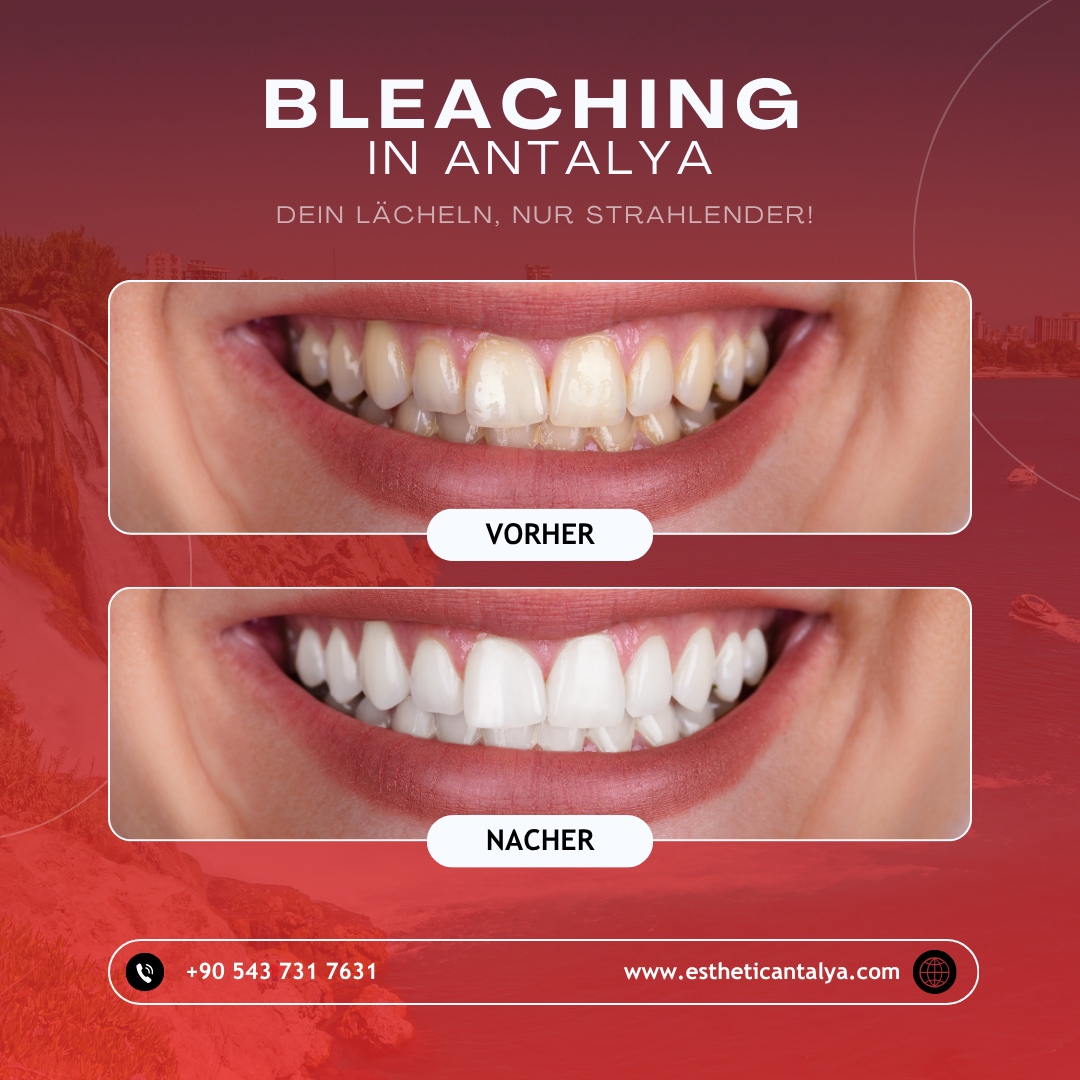 Esthetic Antalya ( Plastic Surgery - Obesity Surgery - Dentistry - Hair Transplantation ) — Dr.Visor photo 3
