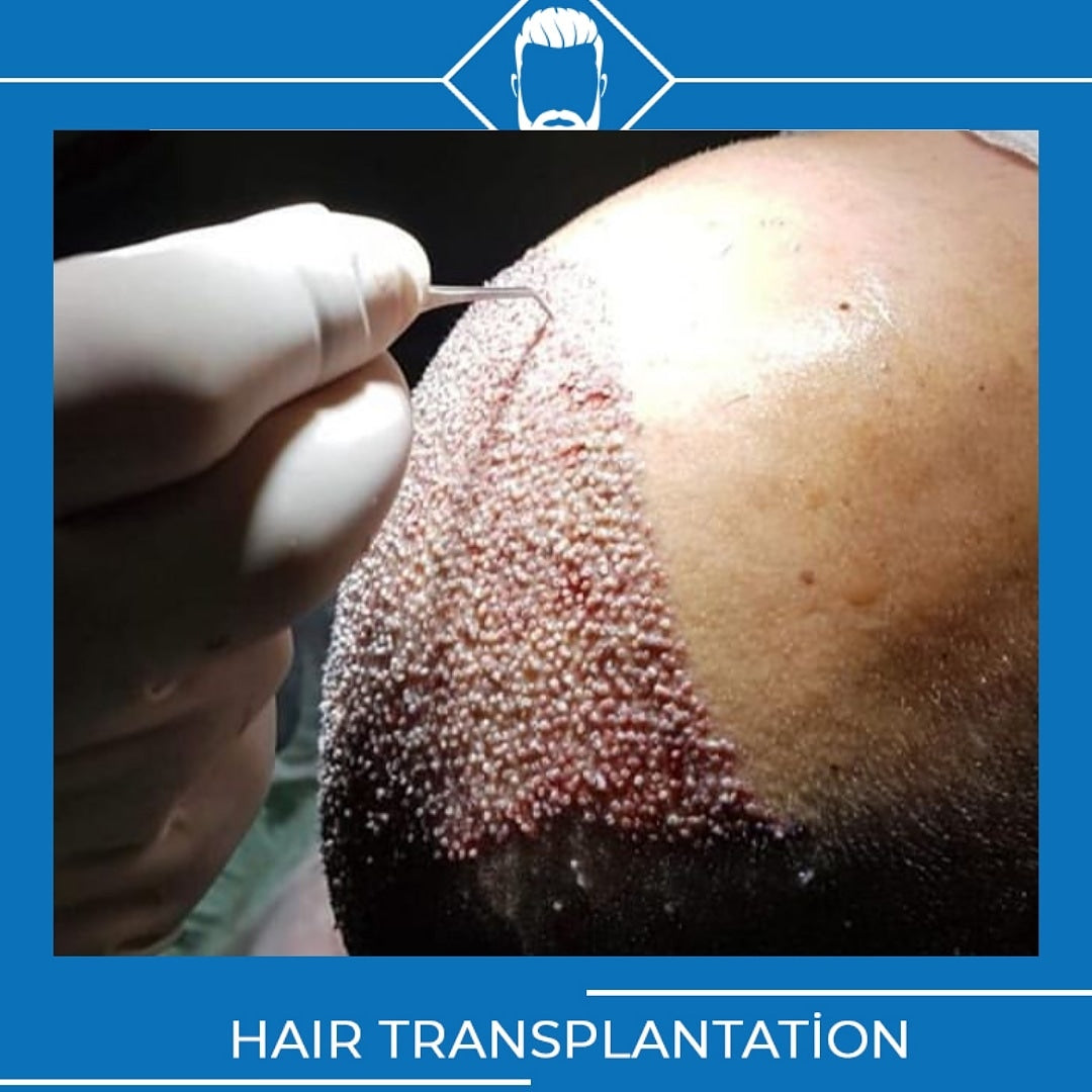 Data Hair Clinic & Eyyüp Tütüncü Saç Ekim Merkezi — Dr.Visor photo 3