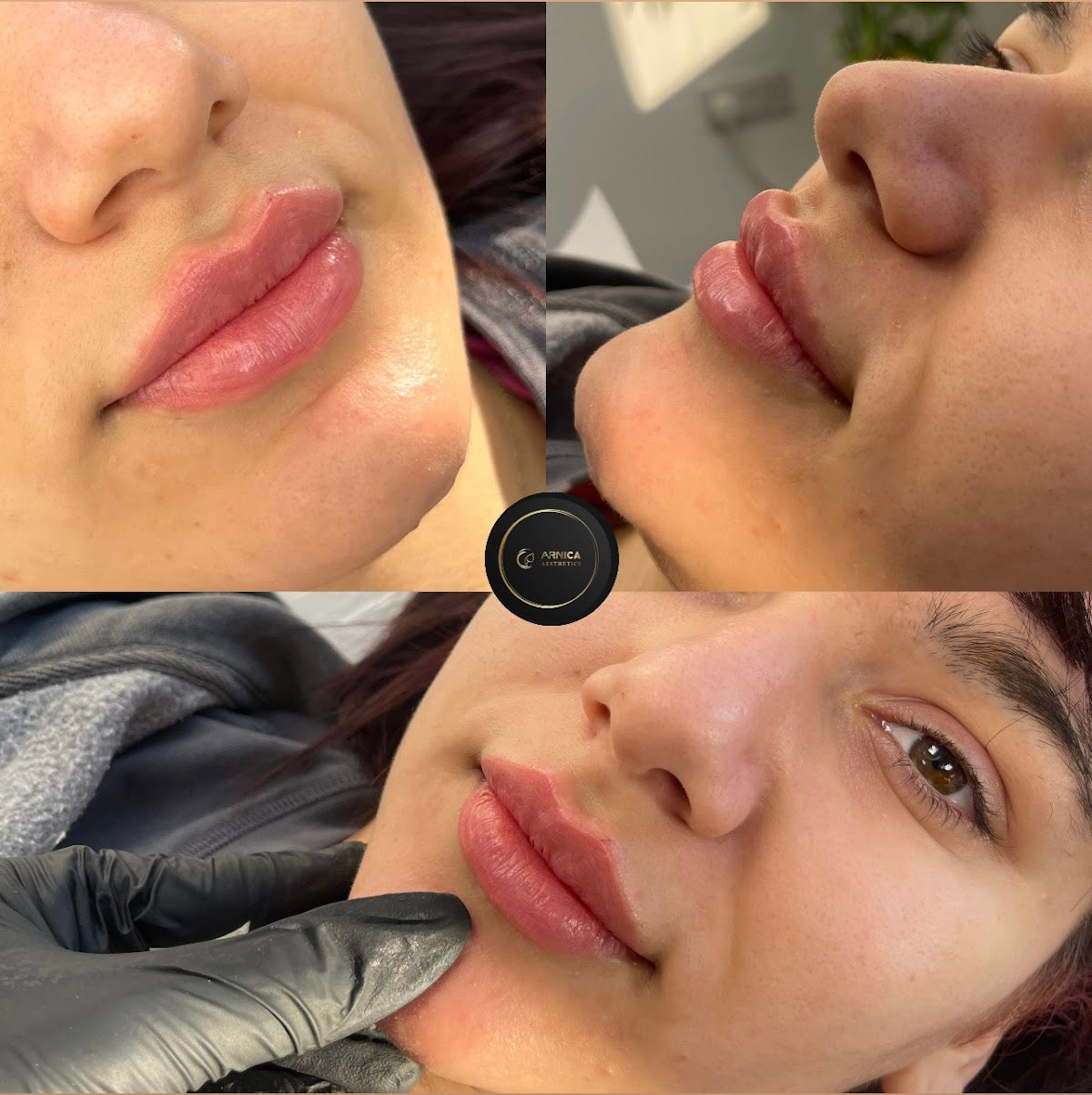 Arnica Aesthetics Clinic — Dr.Visor photo 4