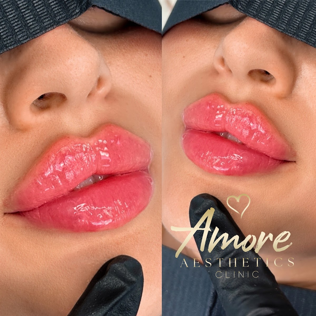 Amore Aesthetics — Dr.Visor photo 2
