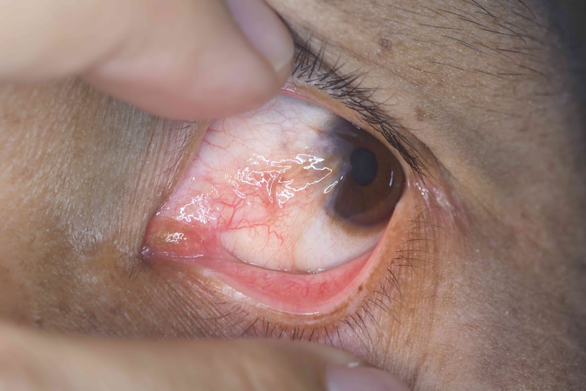 Edgbaston Eye Consultants — Dr.Visor
