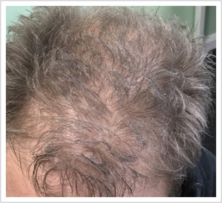 UK Hair Transplant Clinics Edinburgh — Dr.Visor photo 2