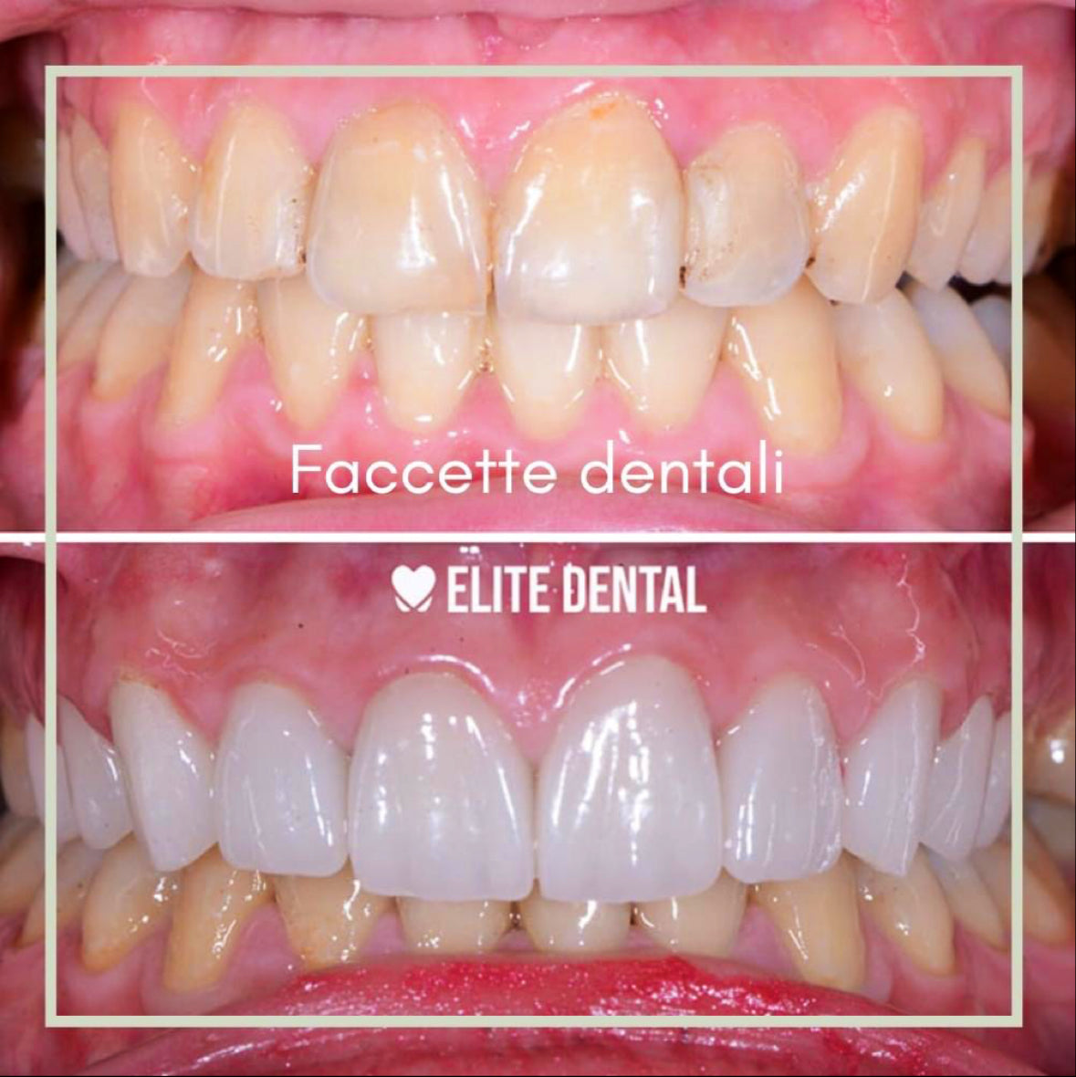 Elite Dental - Dental clinic in Tiranë, Albania
