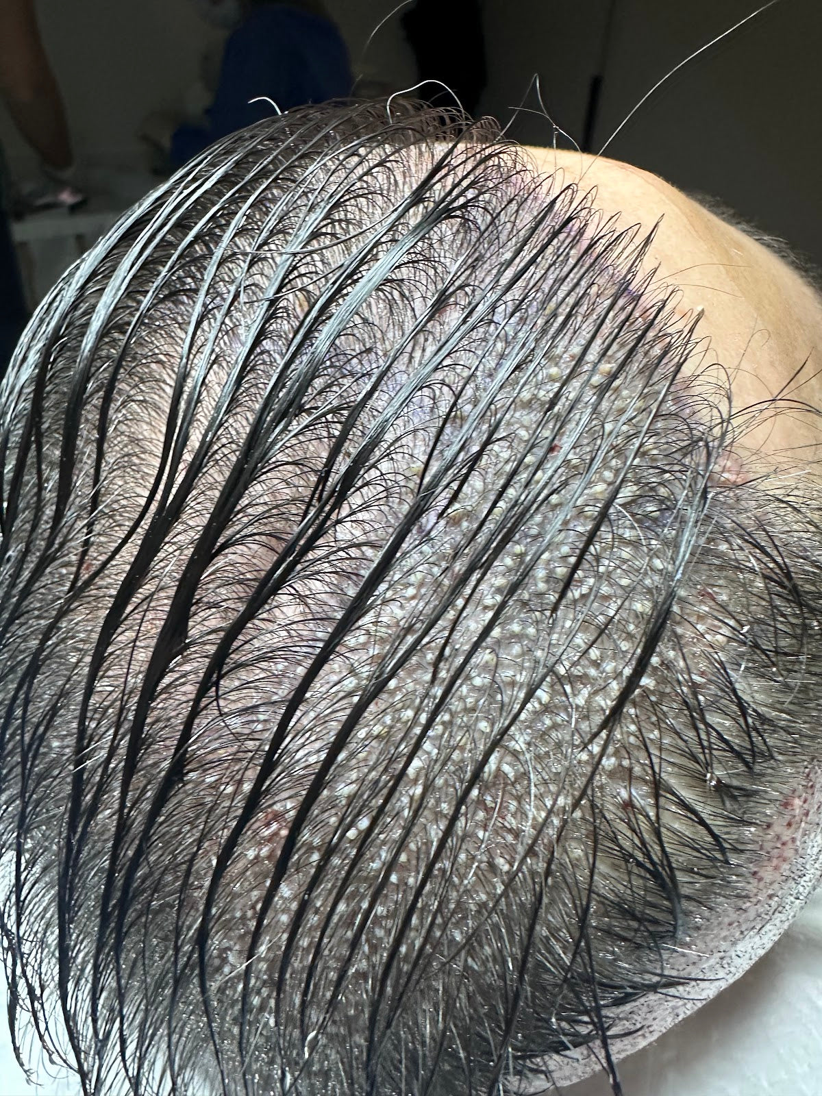 Hair Center Saç Ekim Merkezi — Dr.Visor photo 3