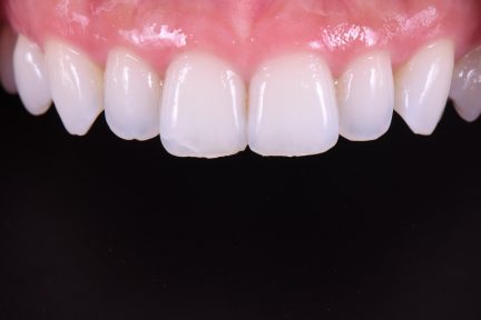 Great Hampton Dental — Dr.Visor photo 4