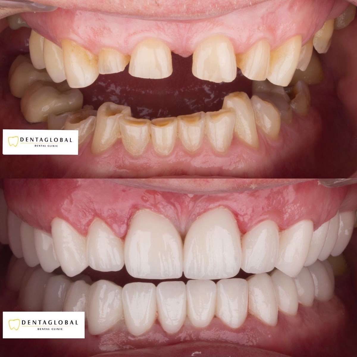 Dentaglobal Ağız Ve Diş Sağlığı Polikliniği — Dr.Visor photo 4