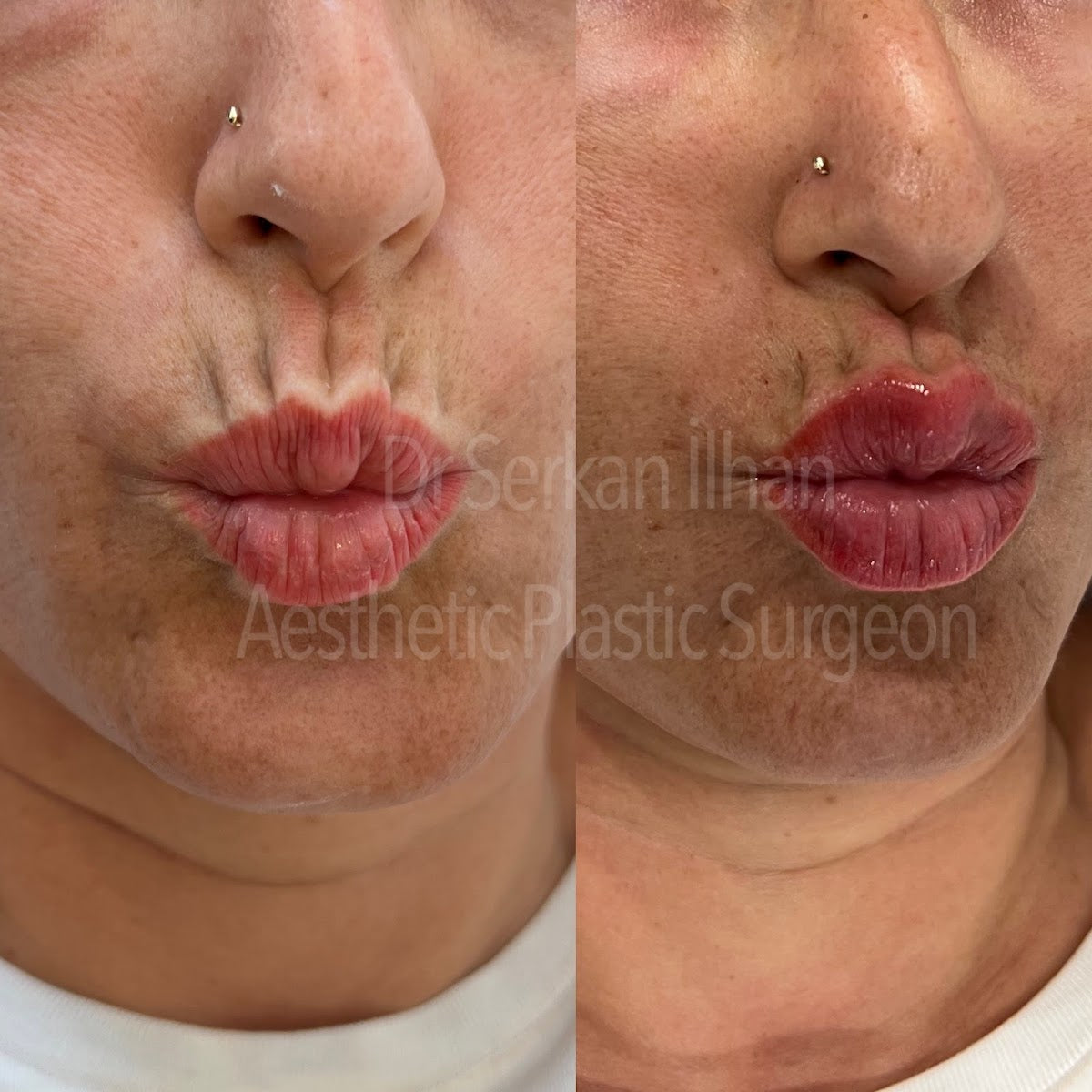 Dr. Serkan İlhan | Aesthetic & Plastic Surgery Clinic Antalya — Dr.Visor photo 4