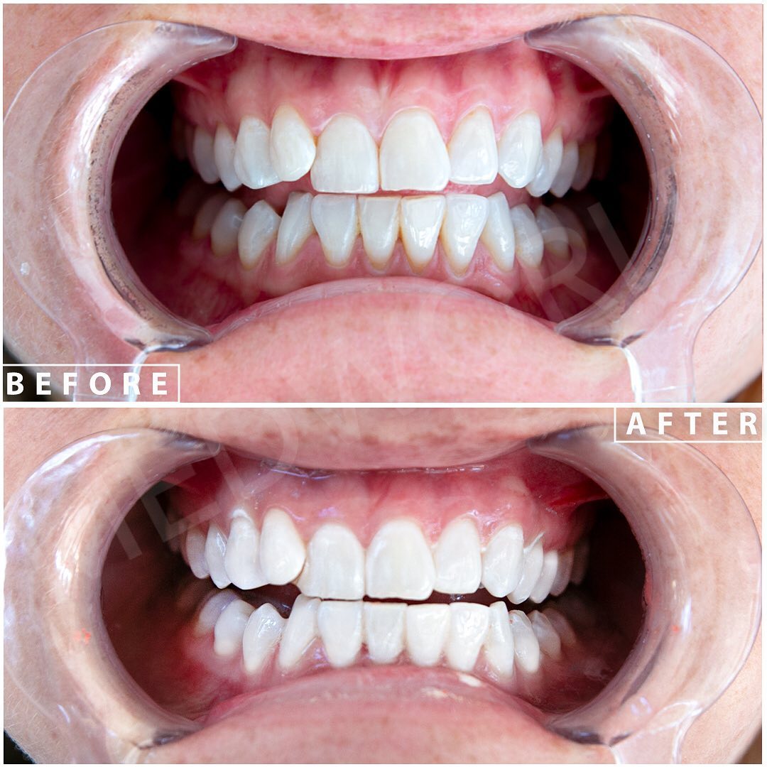 Lara Smile Dental Clinic Turkey — Dr.Visor photo 2