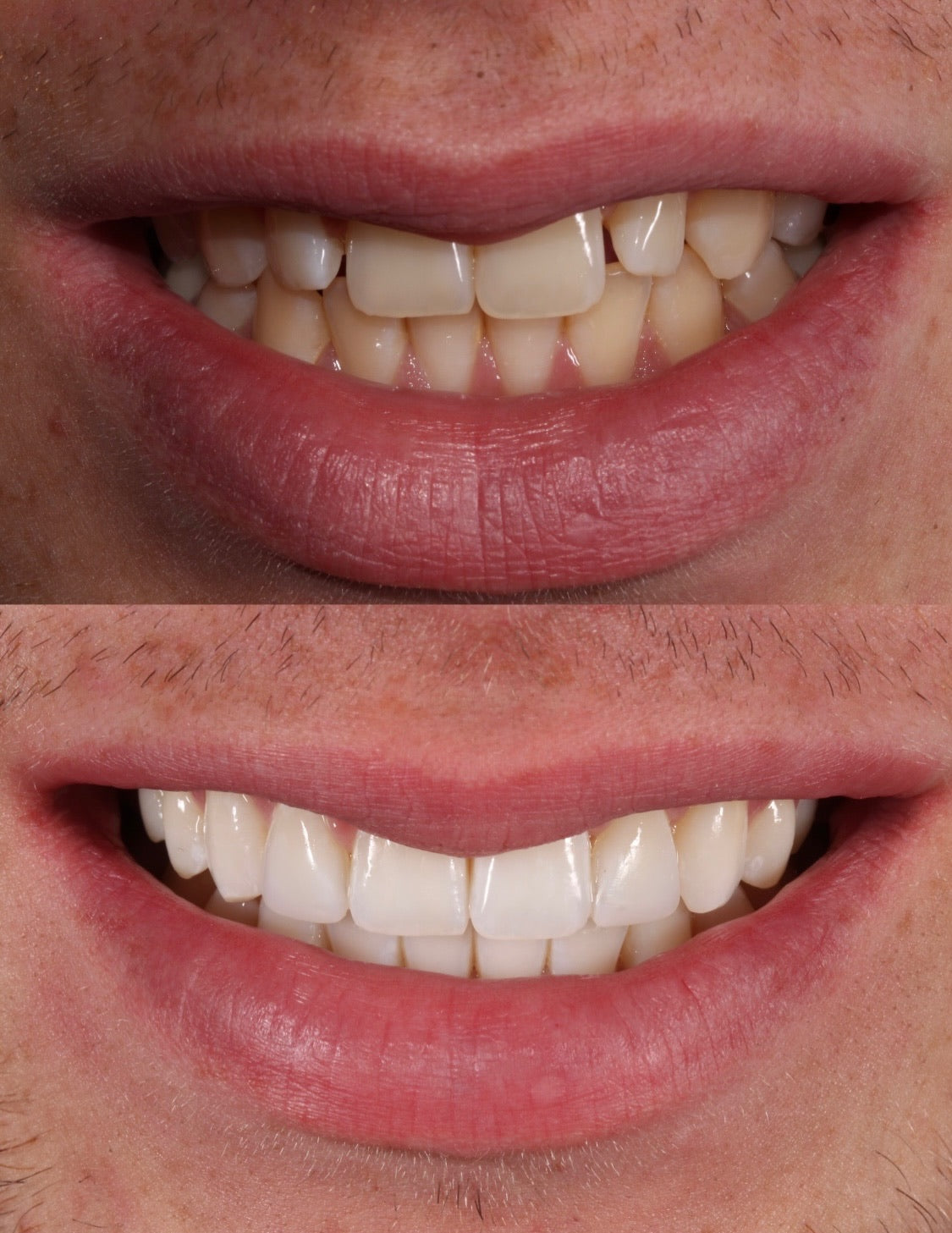 VICI Dental — Dr.Visor photo 3