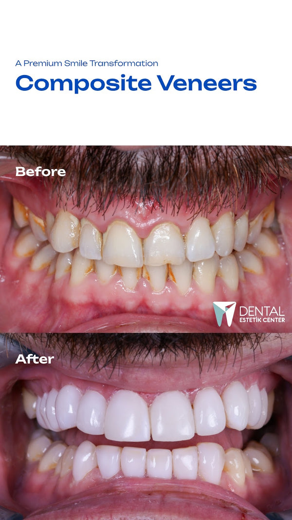 Dental Estetik Center