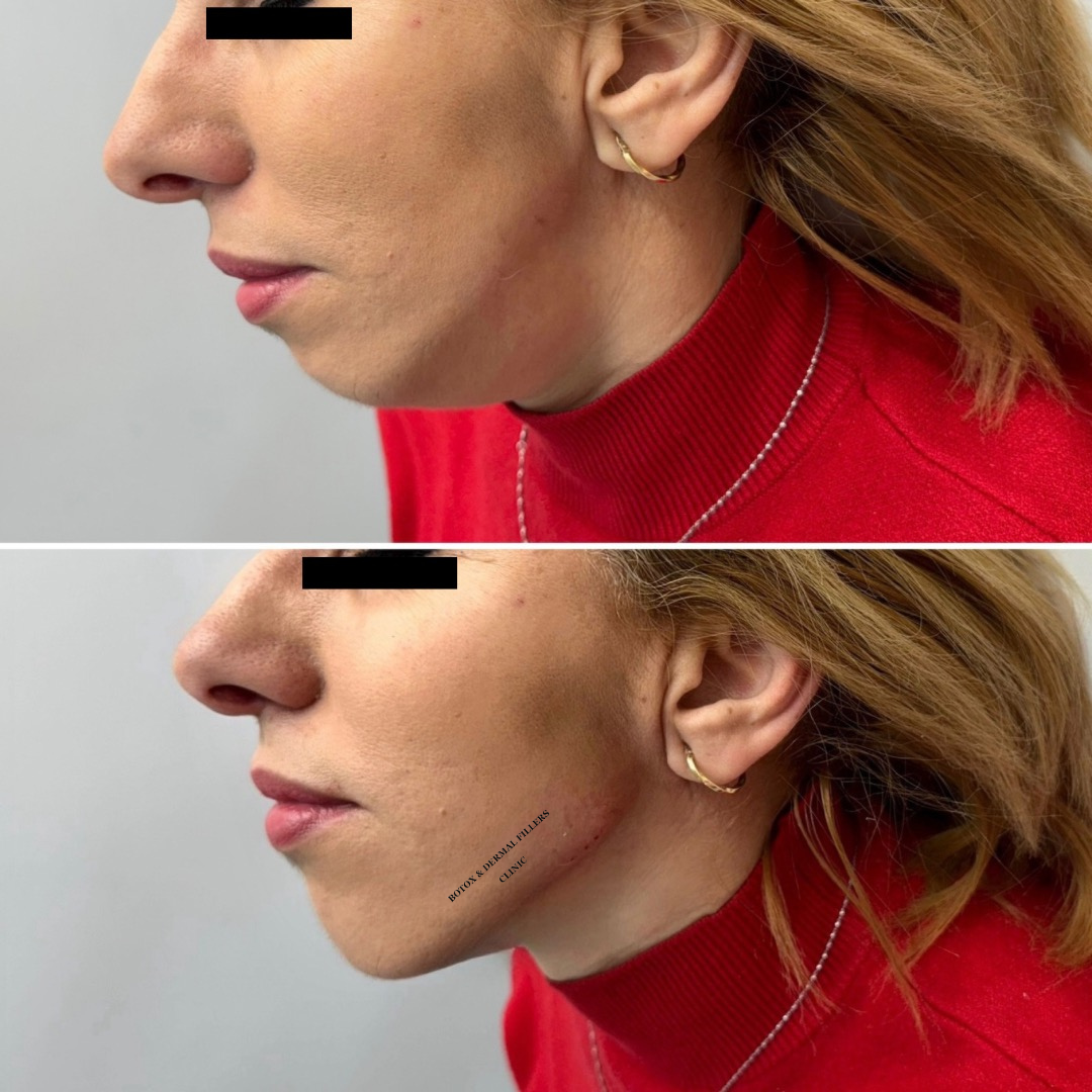 Aesthetics Clinic London — Dr.Visor photo 3