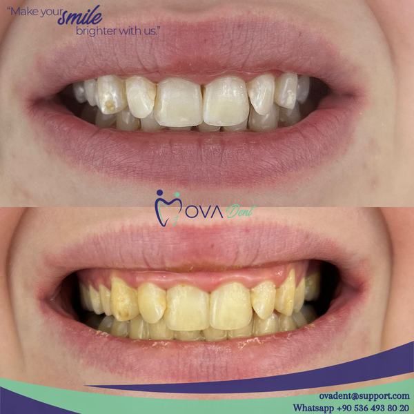 Alanya OvaDent Dental Clinic