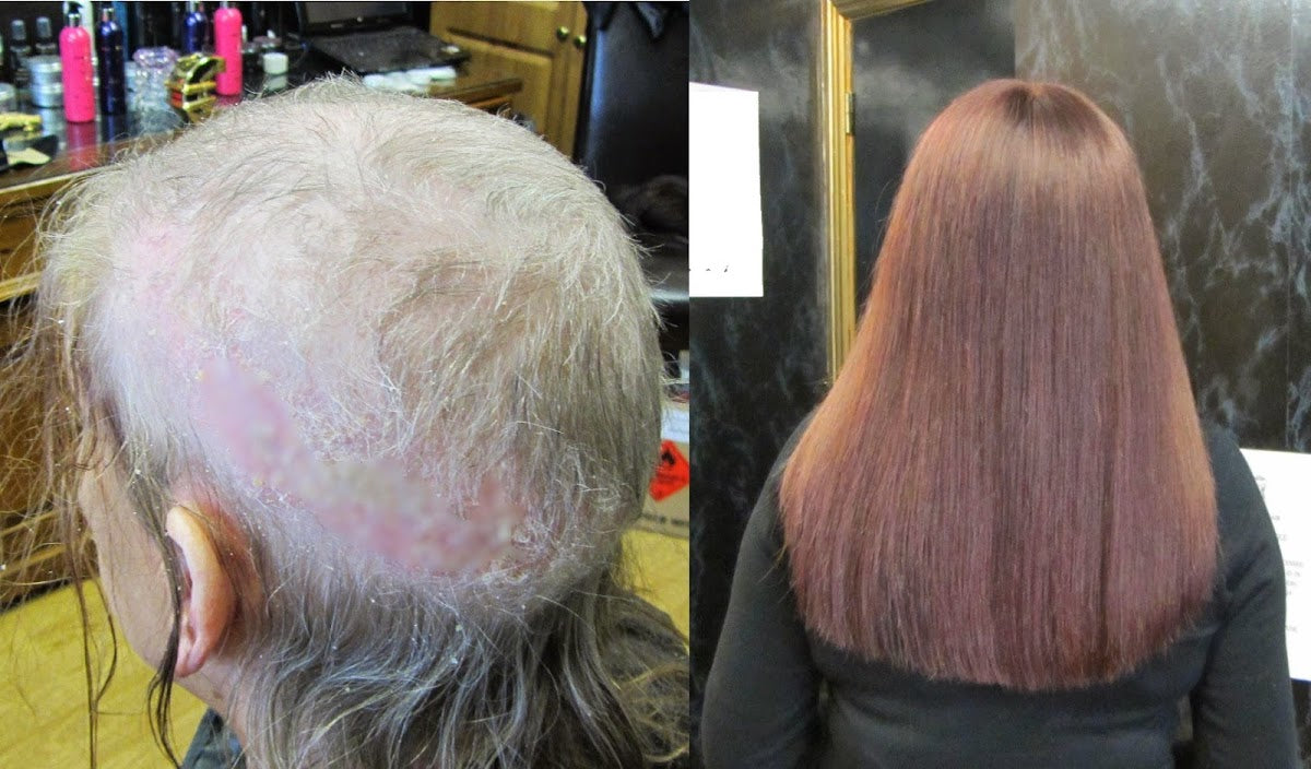JK Hair Replacement Dublin — Dr.Visor photo 5