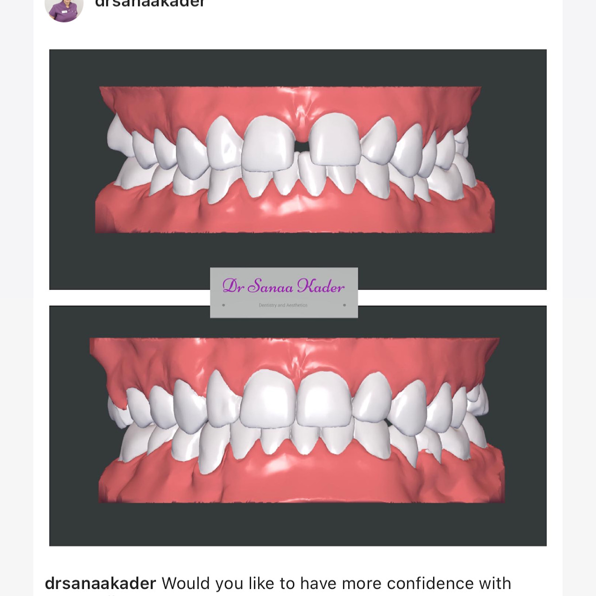 Indigo Dental — Dr.Visor photo 2