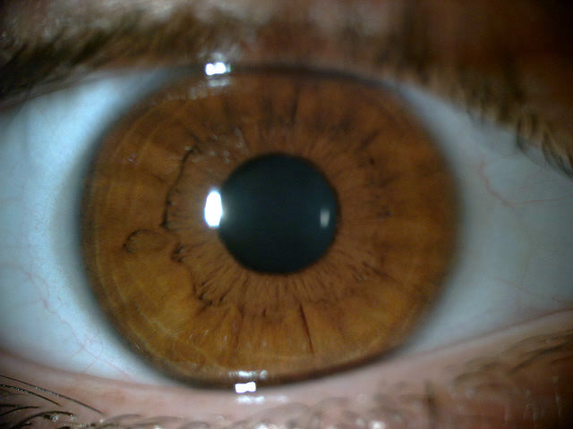 Alanya Göz Kliniği Op. Dr. Bülent Kalay — Dr.Visor photo 3