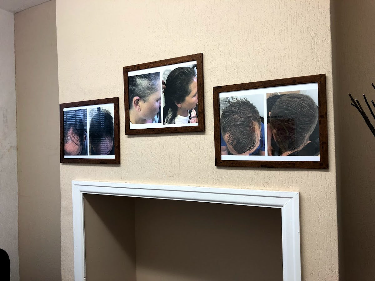 Leeds Hair Loss Clinic — Dr.Visor photo 2