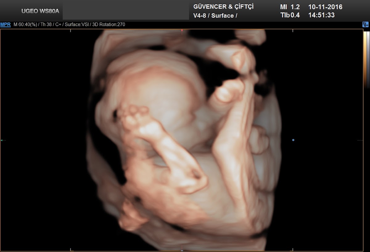 Op. Dr. Çağlar Çiftçi - Kadın Hastalıkları ve Doğum Uzmanı — Dr.Visor photo 2