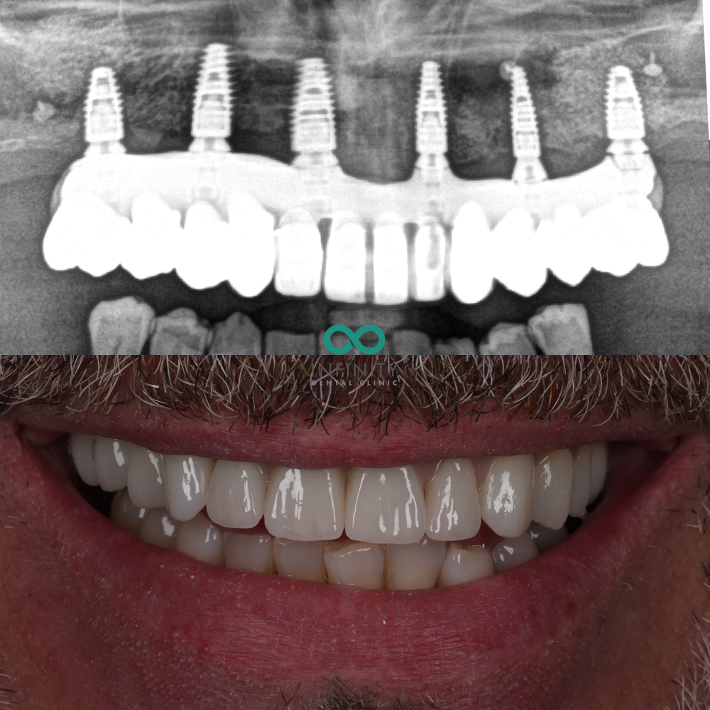 Infinity Dental Clinic — Dr.Visor photo 2