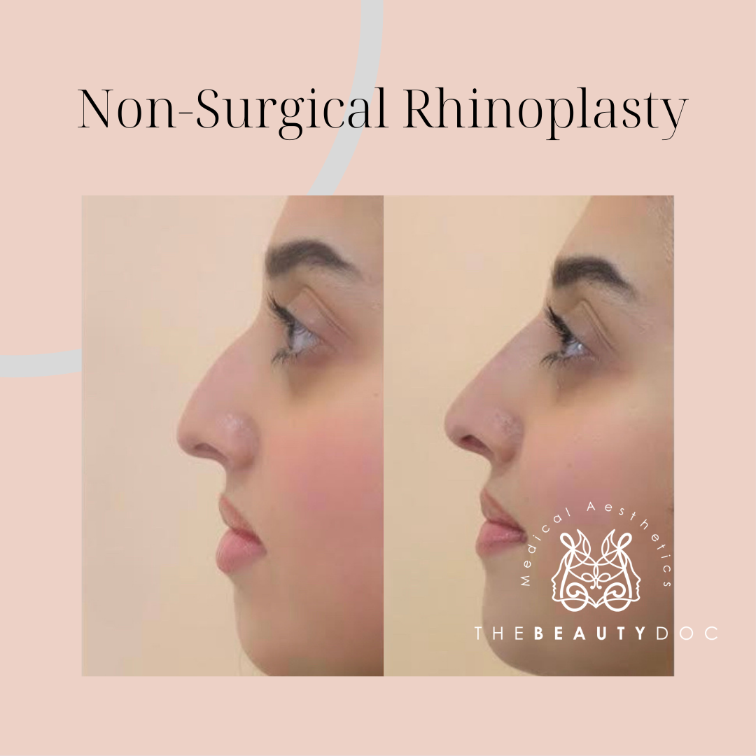 The Beauty Doc : Solo Aesthetic Medical Doctor : Multi-Award Winning — Dr.Visor photo 5
