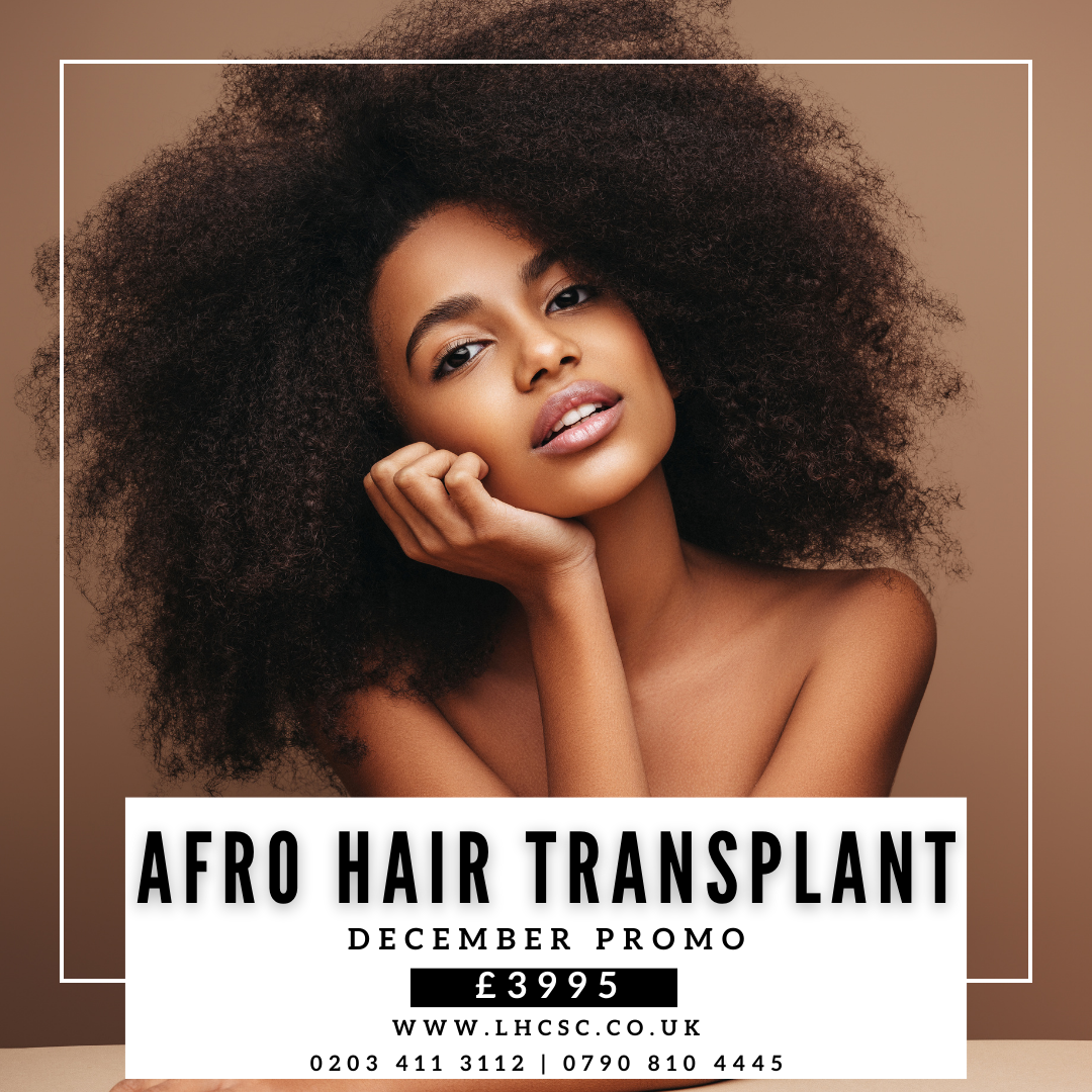 London Hair Transplant Clinic — Dr.Visor photo 2