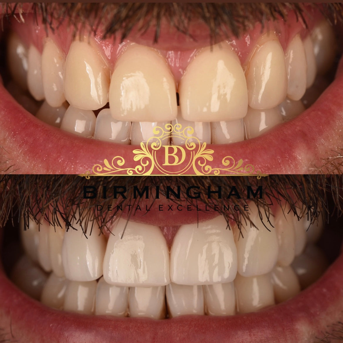 Birmingham Dental Excellence — Dr.Visor