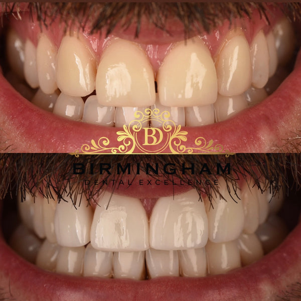 Birmingham Dental Excellence