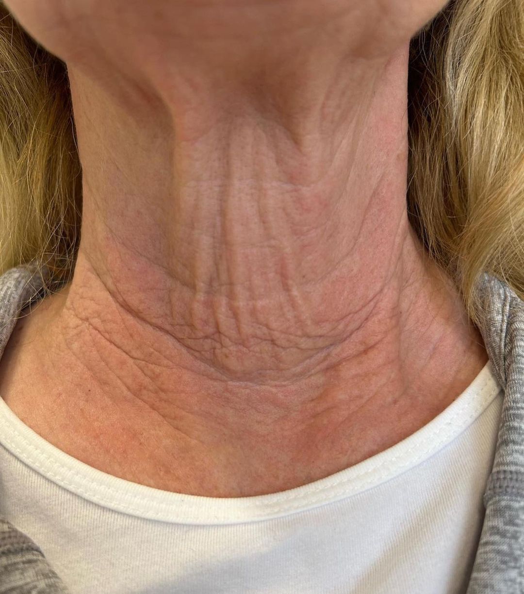 Vivid Clinic | Cosmetic Surgery Istanbul, Turkey — Dr.Visor photo 2